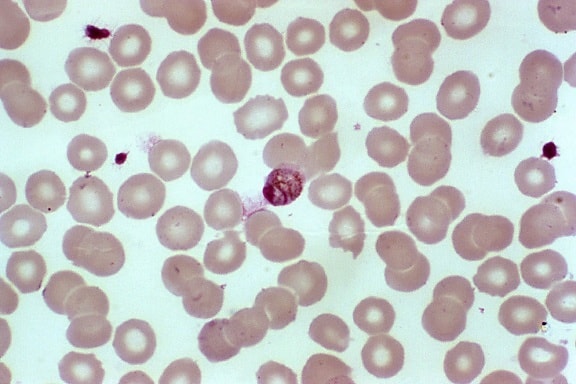 φωτομικρογράφο, δείχνει, Ώριμο, plasmodium malariae, trophozoite, λοίμωξη