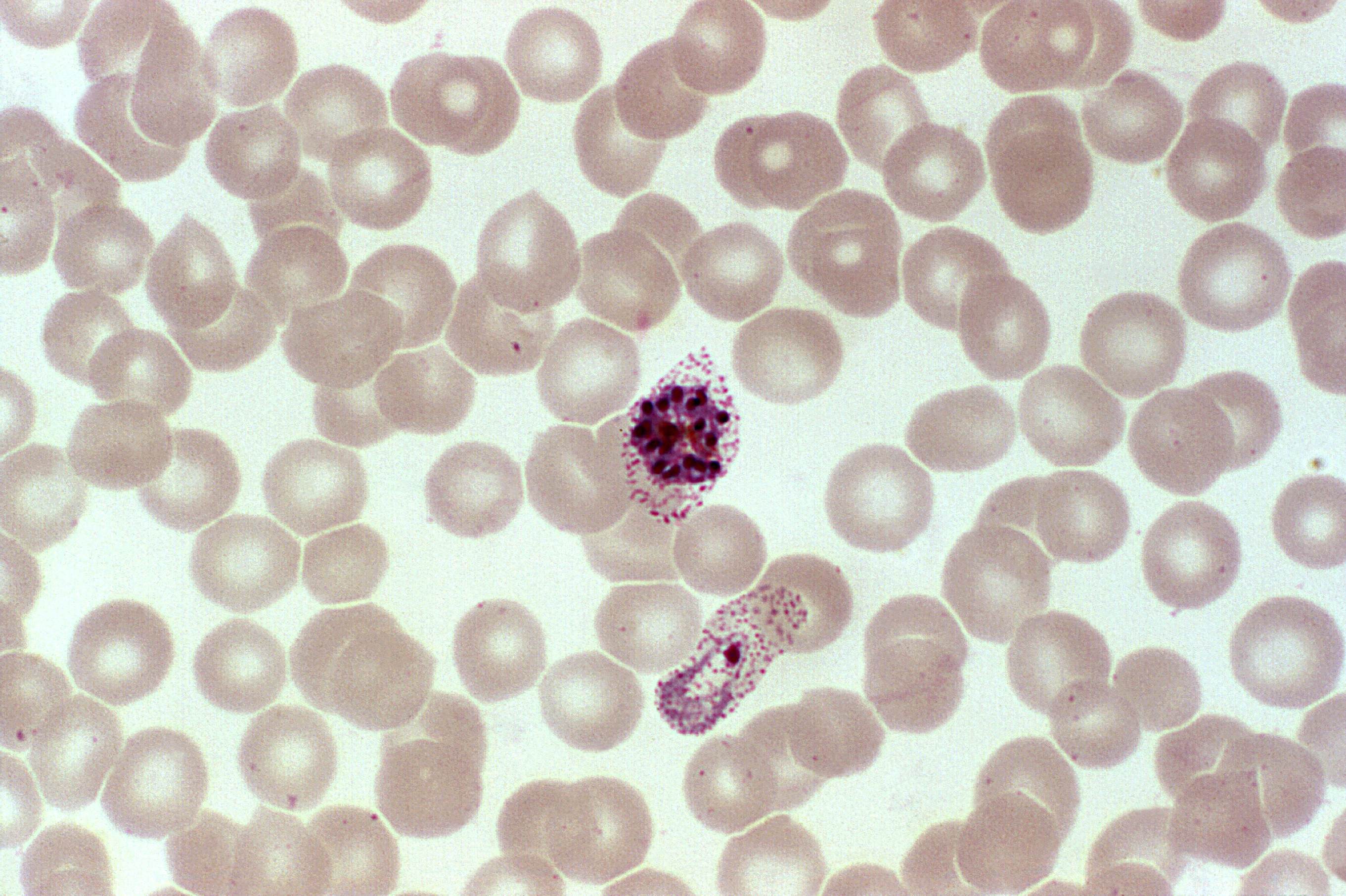 Малярийный плазмодий клетка. Плазмодий Vivax. Малярийный плазмодий Вивакс. Плазмодиум малярия Plasmodium malariae. Малярийный плазмодий микроскопия.