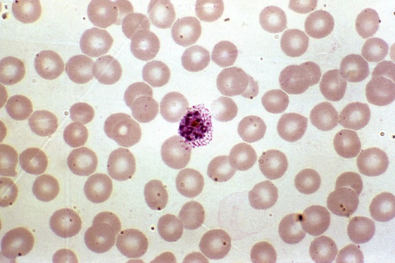 photomicrograph แสดง สีแดง เลือด เซลล์ ติดเชื้อ พลาสโมเดียม vivax, schizont เวที ขยาย 1000 x