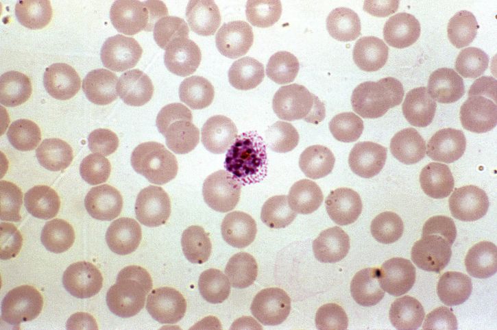 photomicrograph, shows, red, blood, cell, infection, plasmodium vivax, schizont, stage, magnified, 1000x