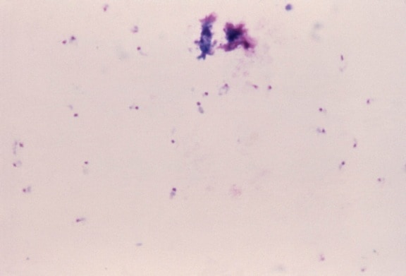 thick, blood smear, photomicrograph, comma, shaped, plasmodium falciparum, parasite