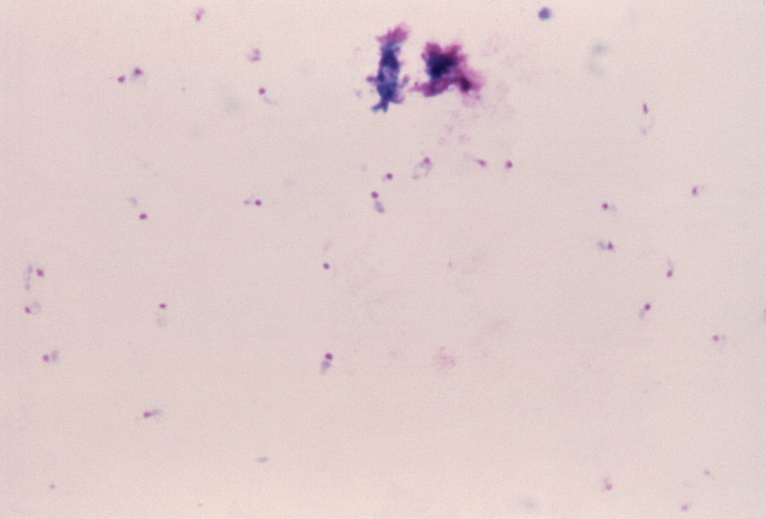 Кровь на малярию. Малярийный плазмодий под микроскопом. Толстая капля под микроскопом.