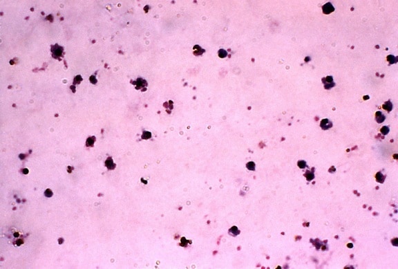 gruesa, película, Aotus, mono, muestra de sangre, Plasmodium falciparum, parásitos, 72hrs, la incubación, la mancha