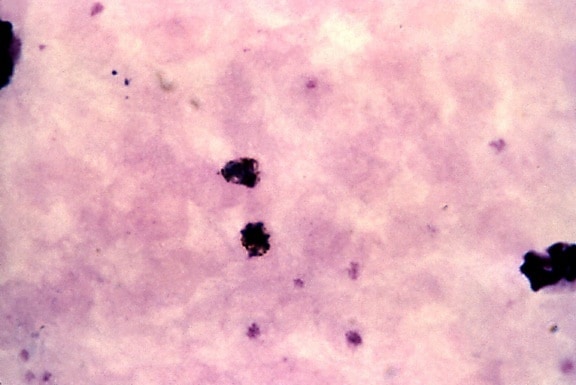 厚、膜、血液塗抹標本顕微鏡写真、未熟な四日熱マラリア原虫シゾント