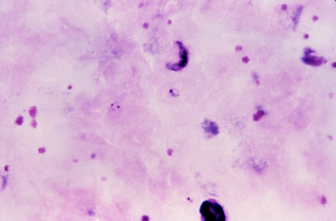 Free Picture Thin Film Micrograph Immature Plasmodium Vivax Schizont