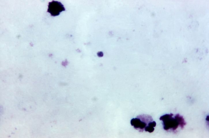tyk, film, photomicrograph, voksende, plasmodium malariae, trophozoite, bejdse, forstørret, 1125 x