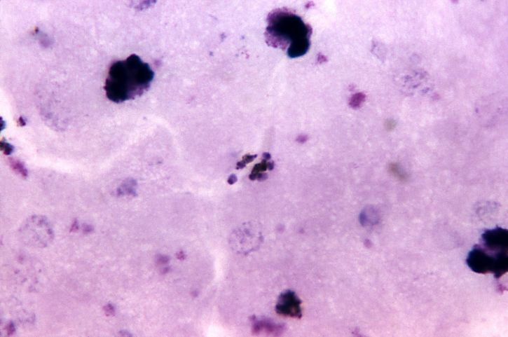厚, 膜, 显微照片, 成熟, 疟原虫 malariae, 裂殖体, 着色, 放大, 1125