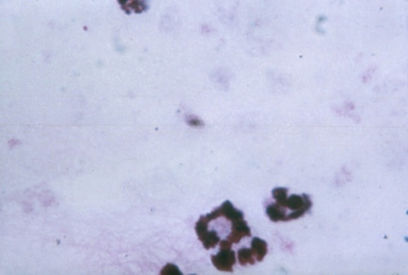 厚, 膜, 显微照片, 显示, 恶性疟原虫, gametocyte, 细胞质, 色素, 明显