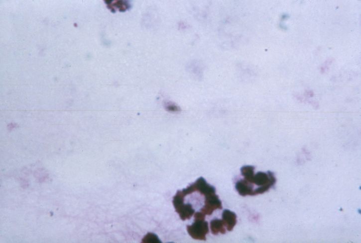 дебел, филм, микроснимка, показва, плазмодий falciparum, gametocyte, цитоплазмата, пигмент, очевидно