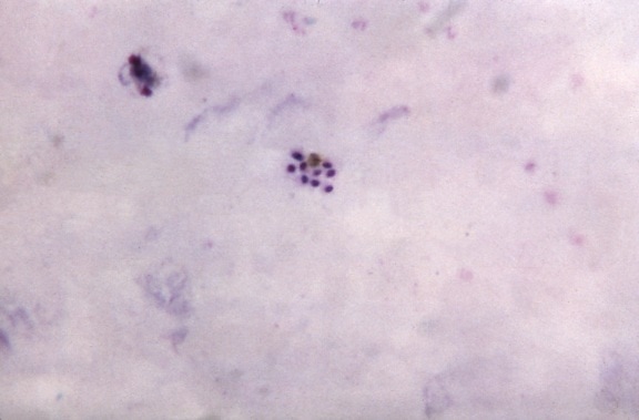 หนา ฟิล์ม สไลด์ แก่ ๆ malariae, schizont แสดง แตกต่าง ไซโทพลาซึม merozoites