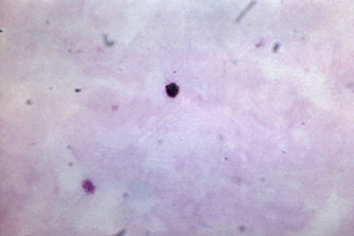 gruesa, película, muestra, cada vez mayor, Plasmodium malariae, trophozoite