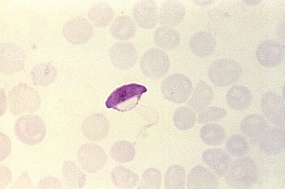 tunn, film, Mikrograf, parasitiska, falciparum microgametocyte