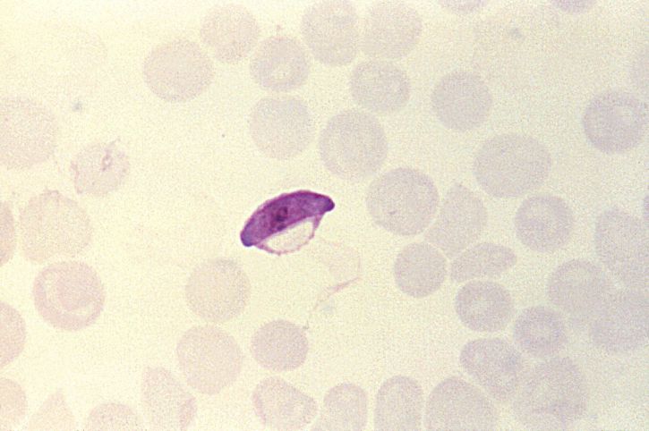 delgada, película, micrografía, parasitaria, Plasmodium falciparum, microgametocito
