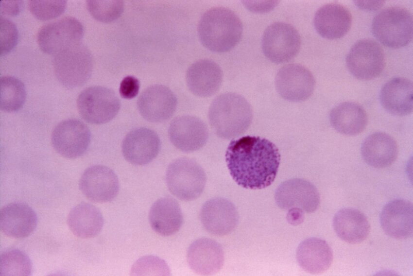 Free Picture Thin Film Micrograph Plasmodium Vivax Macrogametocyte