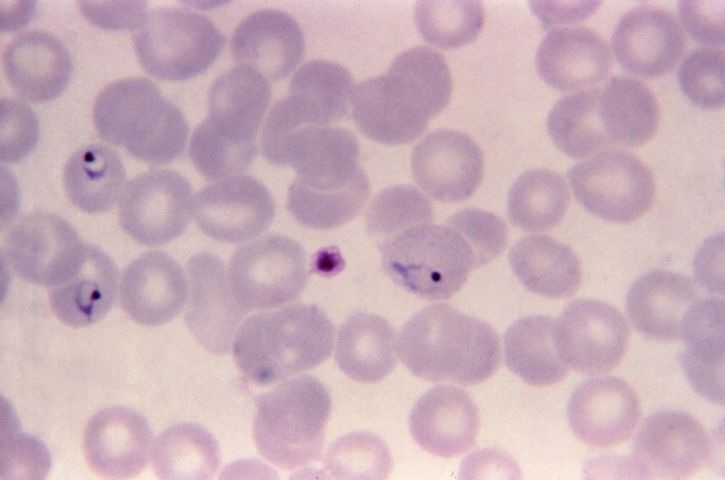 薄いフィルム、顕微鏡写真、三日熱マラリア原虫、リング、フォーム、トロフォゾイト