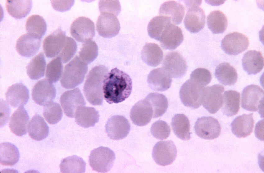 Free Picture Thin Film Micrograph Immature Plasmodium Vivax Schizont