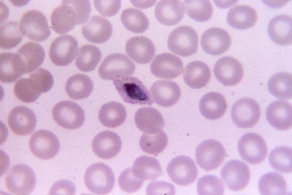 két malária paraziták, vivax, ovale, visszaeső, betegség