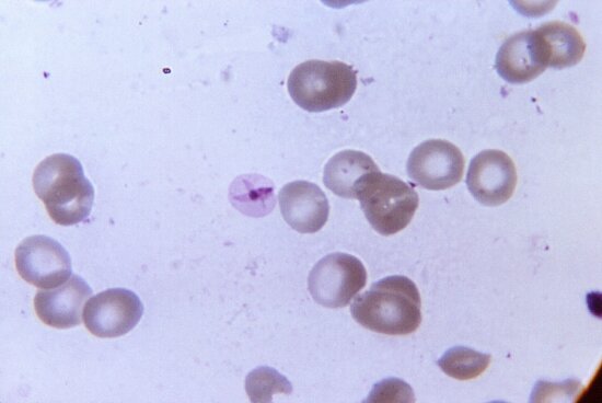 Kostenlose Bild Blutausstrich Mikrophotographie Plasmodium Falciparum Gametocyte