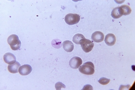 Mikroskooppitutkimus, morfologia, esillä, lomake, rengas, loinen, malaria, plasmodium falciparum
