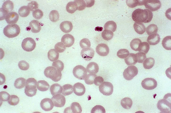 eritrocitarios, esquizontes, rupturas, merozoitos, derramamiento de sangre,, repetición, ciclo, que infectan a los eritrocitos,