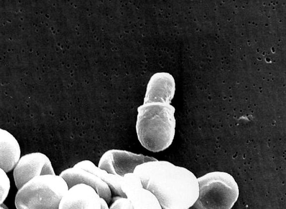 electron micrograph, malasseziafungus