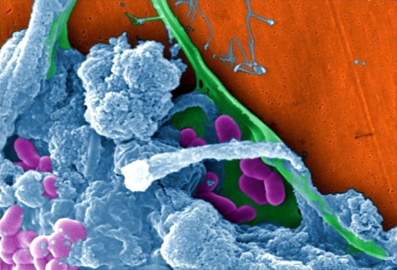 มวล เสมอ ฟิล์ม enmeshed, amoebae หมายเลข จุลินทรีย์ แบคทีเรีย