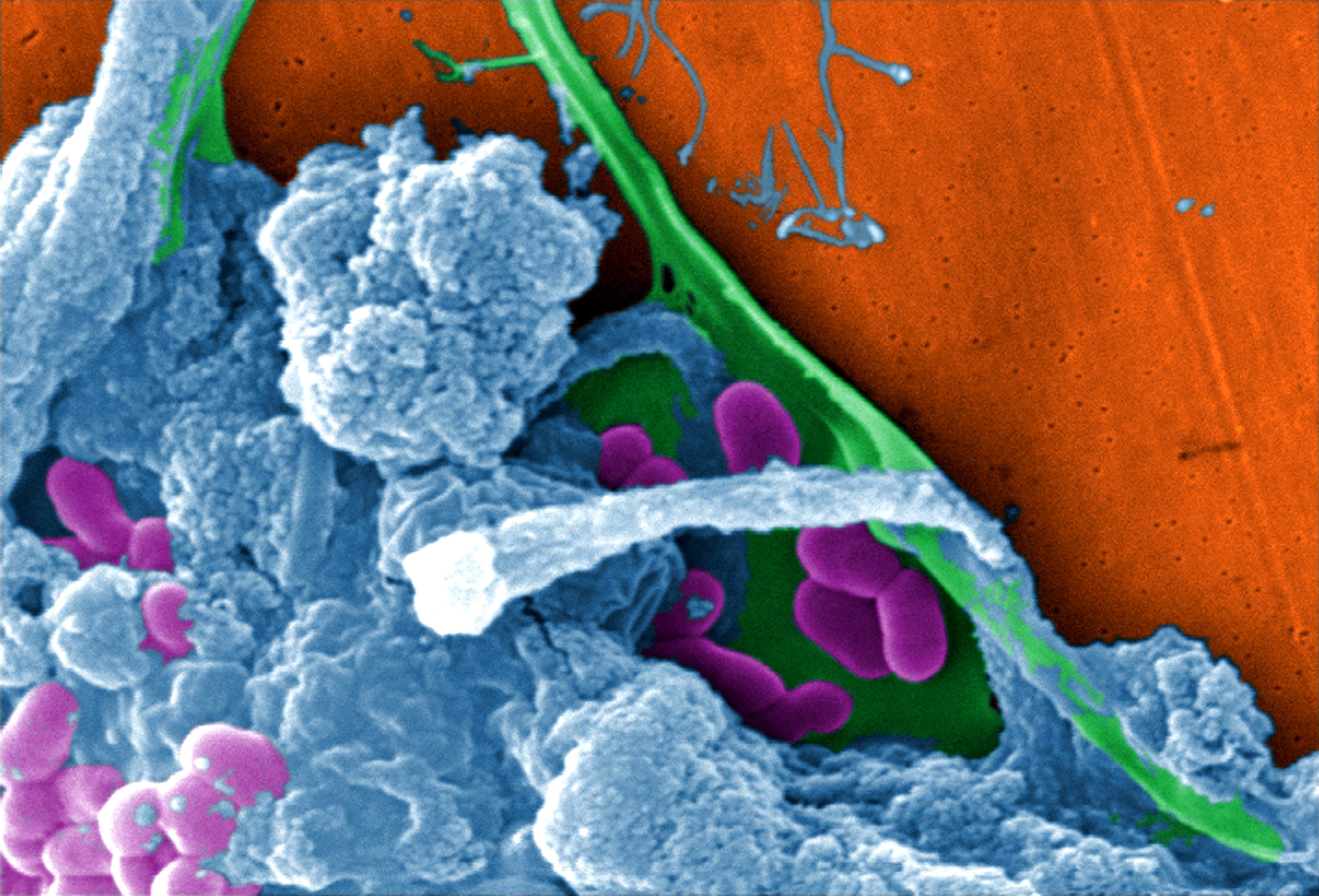 Разрушающие микроорганизмы. Биопленки микробиология. Биопленки микроорганизмов. Бактериальные биопленки строение. Микробные биопленки.
