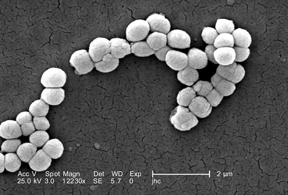 ขยาย 12230 x, morphologic กรัม บวก micrococcus luteus แบคทีเรีย