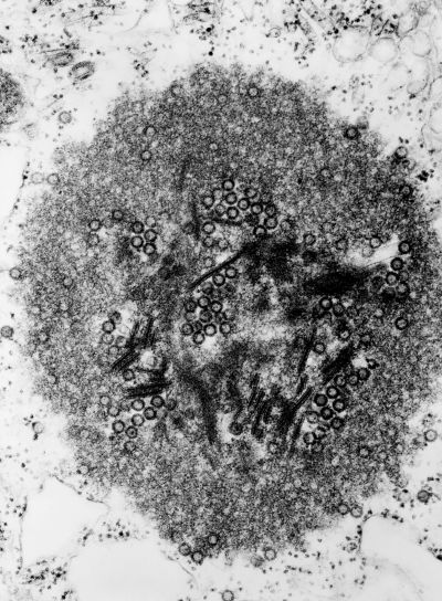 morfologické detaily, Tribeč, virus, člen, rod, orbiviruses