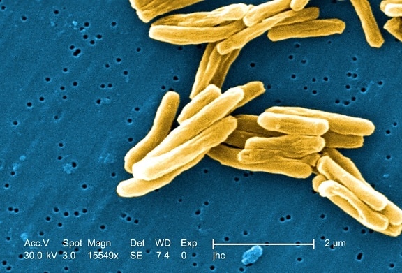 gram, positief, mycobacteriën, tuberculose, bacteriën