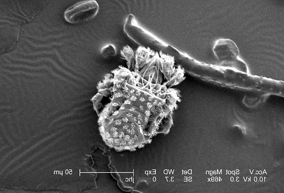 nanorchestes nanorchestidae, fungivorous, microbiology, microorganism, photomicrograph, organism