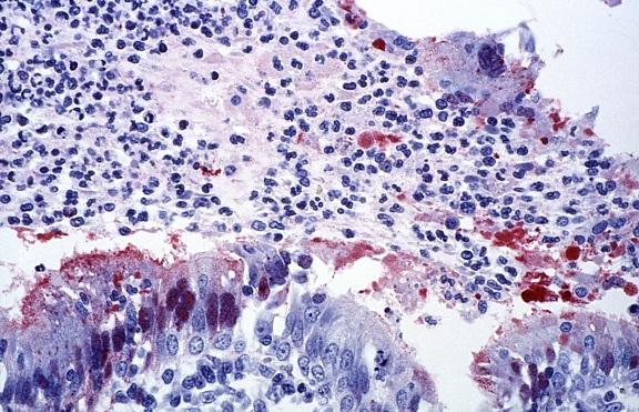 cytoarchitectural trachea bronchioles, brought, nipah virus, infection
