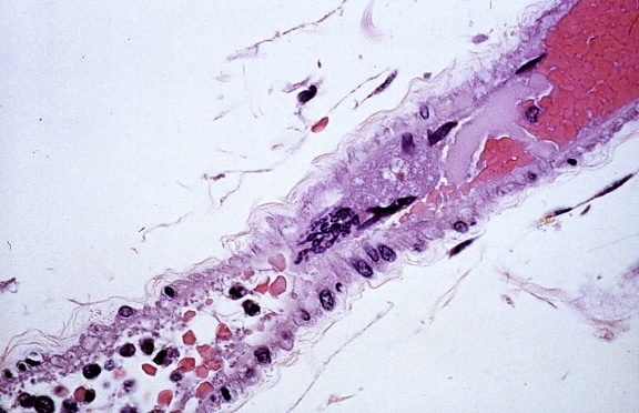 гигантски, мултинуклеарни, ендотелните, клетка, център, изображение