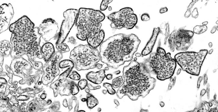 Hendra, virus, cabaline, morbillivirus, familia, Paramyoviridae
