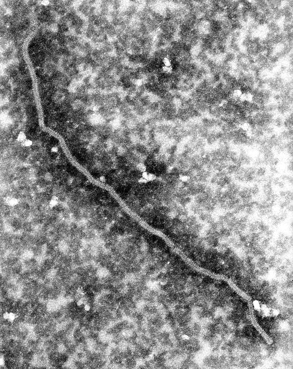 imagem, ultra-estruturais, detalhes, vírus de nipah nucleocapsídeo