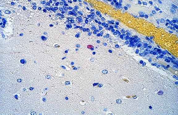 Mikrophotographie, Nipah-Virus, Infektion