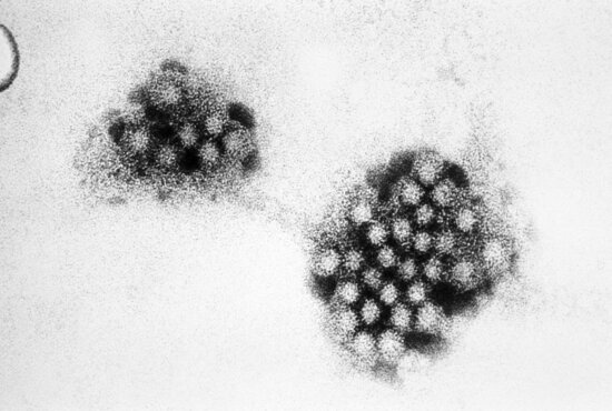 electron micrograph, norovirus, 32nm, sized, viral, particles