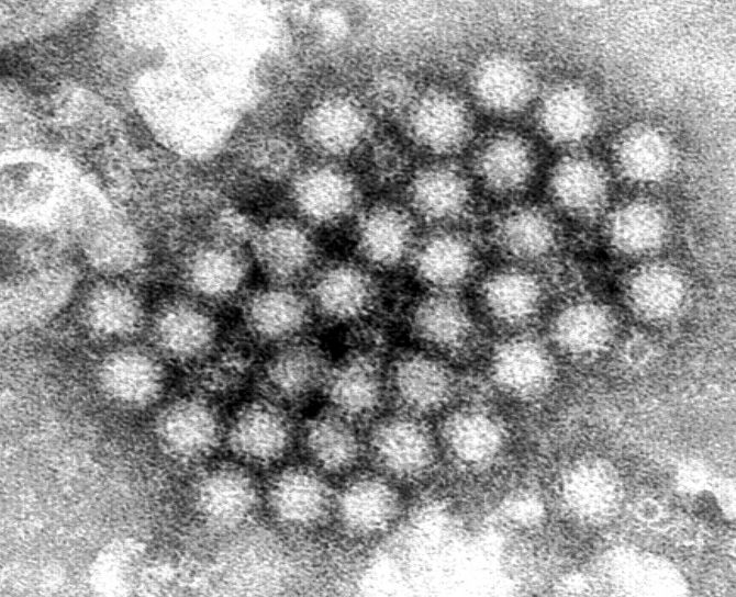 ส่ง บอร์ดอิเล็กตรอน ศึกษาลักษณะชนิด สัณฐานวิทยา norovirus, virions
