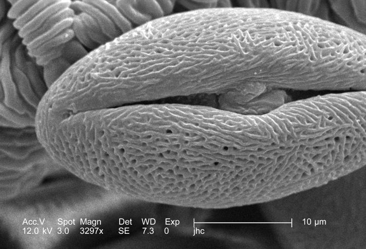 this-pollen-grain-was-of-the-tricolpate-type-of-pollen-which-means-that-the-outer-surface-was-traversed-from-pole-to-pole-725x493.jpg