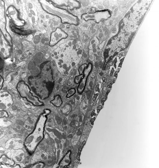 Мікрографіческіе, хоста, ендотелію судин, одній клітинці, показано, багато, організми, безкоштовно, Цитоплазма