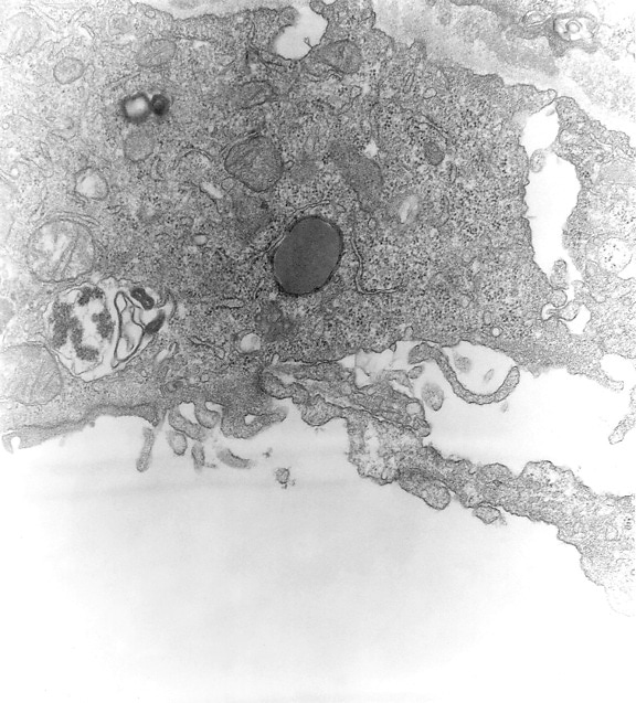 แรก ช่องท้อง mesothelial เซลล์ ส่ง อิเล็กตรอนบอร์ด เมาส์