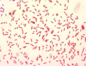 Free picture: application, stain, affinity, pestis, capsular, antigen