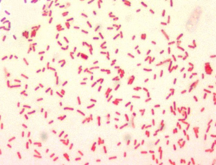 バイポーラ、細菌、汚れ、顕微鏡