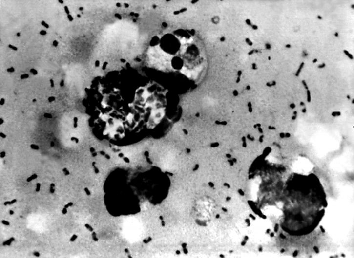 bubonique, la peste, frottis, démontrant, présence, Yersinia pestis, bactéries,