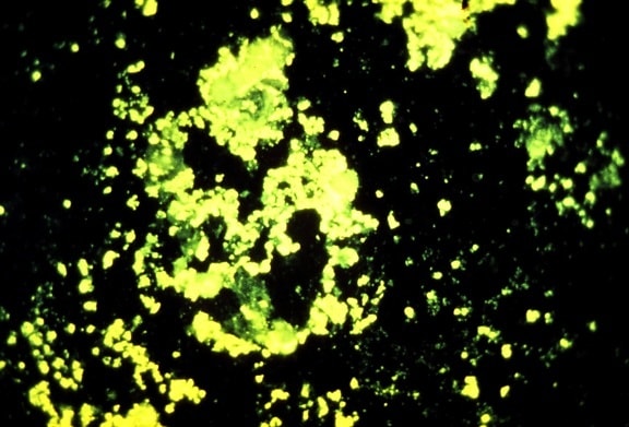 fluorescerende antistoff flekken, yersinia pestis