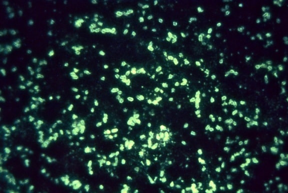 fluorescente, anticorpi, la tecnica, coniugata, antisiero, frazione, l'antigene, Yersinia, pestis