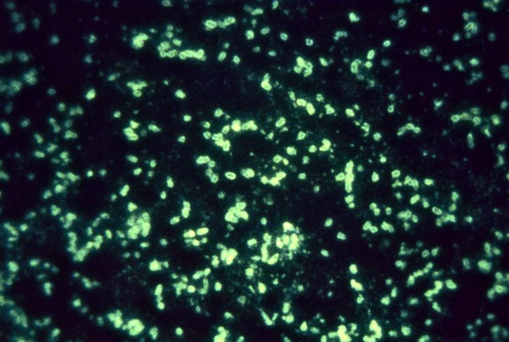 флуоресцентные, антитела, техника, конъюгированных, антисыворотки, фракция, антиген, yersinia pestis