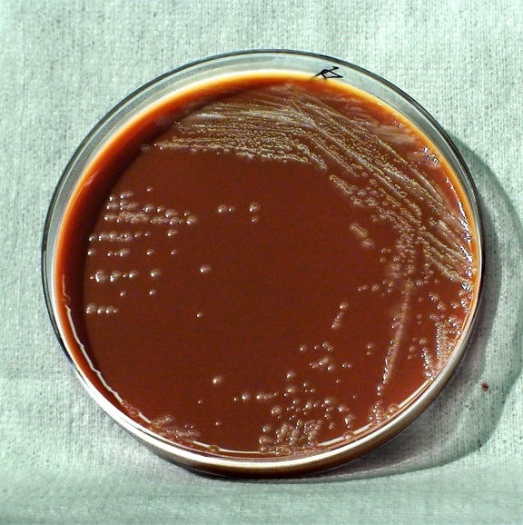 gram, negative, yersinia pestis, bacteria, grown, chocolate, agar