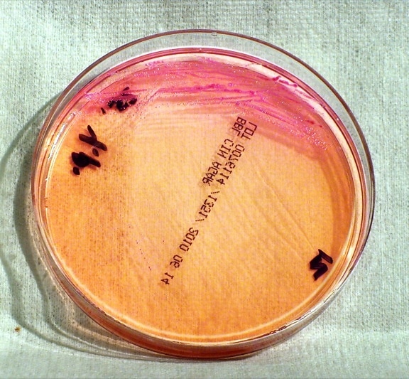 gram, negative, yersinia pestis, bacteria, grown, cefsulodin, irgasan, novobiocin, agar