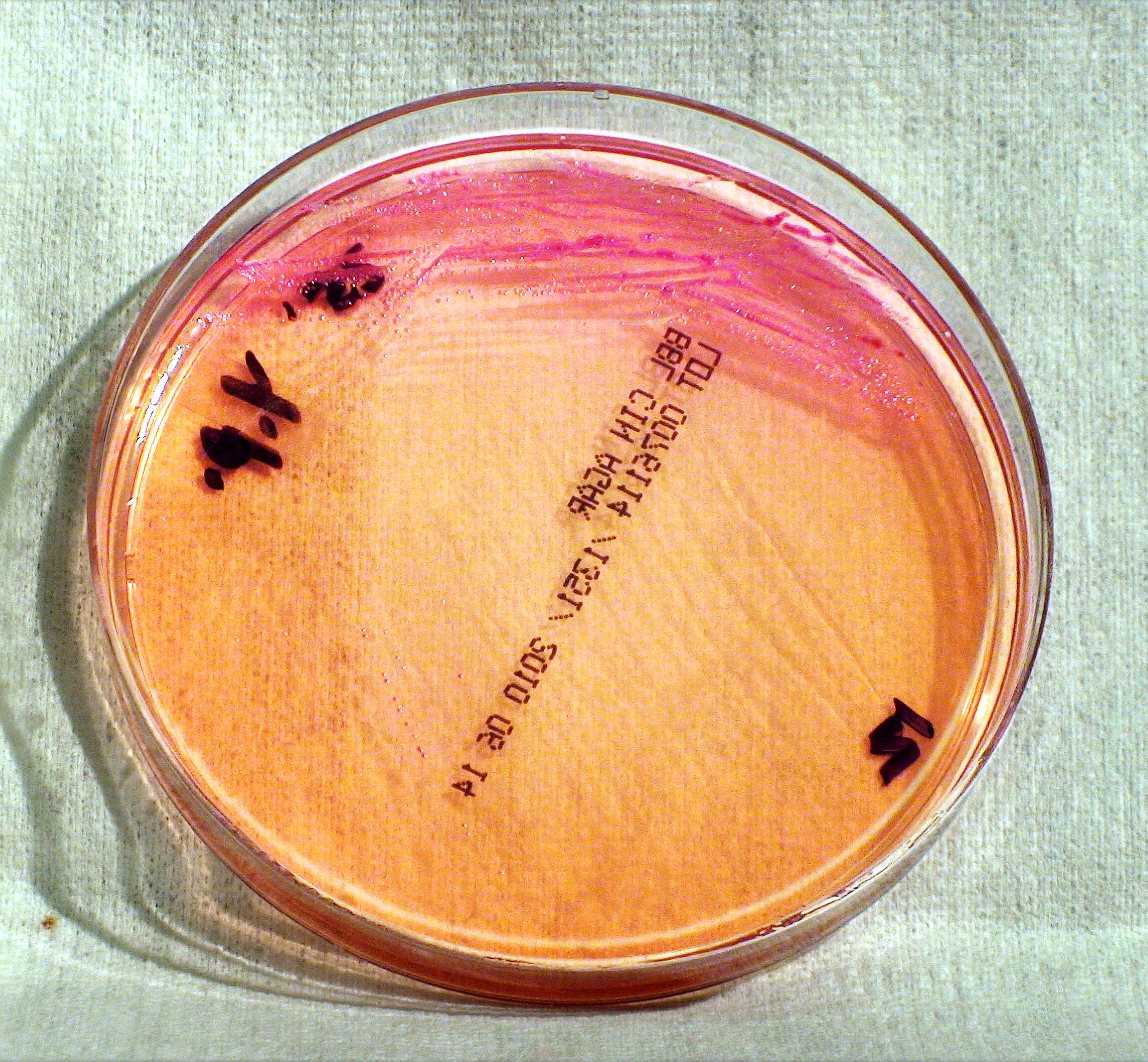 Yersinia Enterocolitica fertőzés